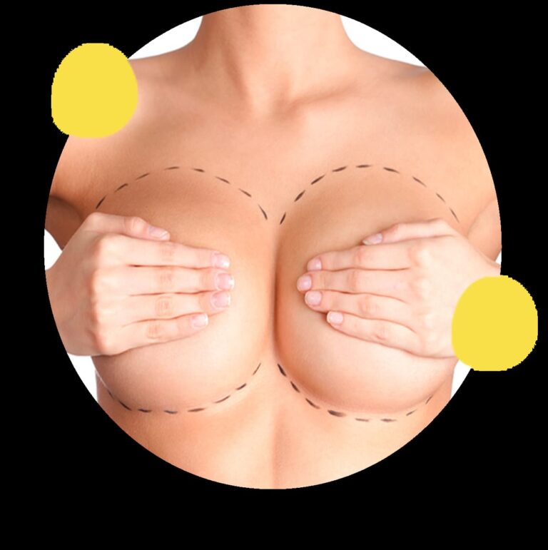 breast aesthetics for women