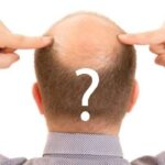Saç ekimi - Hair transplant
